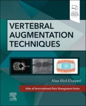 book Vertebral Augmentation Techniques