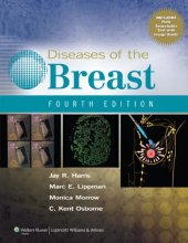 book Diseases of the Breast, 4th Edition