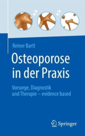 book Osteoporose in der Praxis: Vorsorge, Diagnostik und Therapie ¿ evidence based