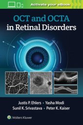 book OCT and OCTA in Retinal Disorders