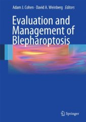 book Evaluation and Management of Blepharoptosis