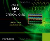 book Atlas of EEG in Critical Care