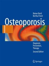 book Osteoporosis: Diagnosis, Prevention, Therapy, 2nd Edition