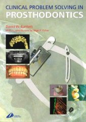 book Clinical Problem Solving in Prosthodontics