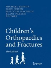 book Children's Orthopaedics and Fractures