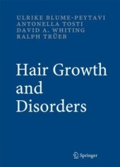 book Hair Growth and Disorders