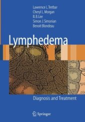 book Lymphedema: Diagnosis and Treatment