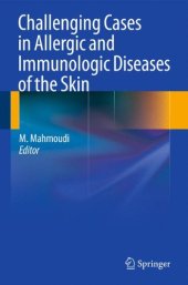 book Challenging Cases in Allergic and Immunologic Diseases of the Skin