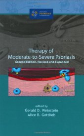 book Therapy of Moderate-to-Severe-Psoriasis, Second Edition,