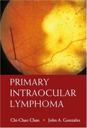 book Primary Intraocular Lymphoma