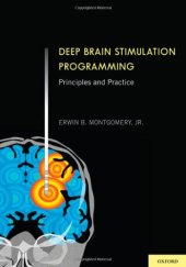 book Deep Brain Stimulation Programming: Principles and Practice