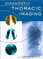 book Diagnostic Thoracic Imaging