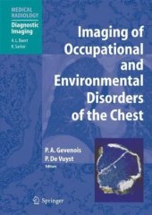 book Imaging of Occupational and Environmental Disorders of the Chest (Medical Radiology   Diagnostic Imaging)