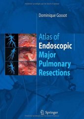 book Atlas of Endoscopic Major Pulmonary Resections