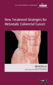 book New Treatment Strategies for Metastatic Colorectal Cancer