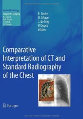 book Comparative Interpretation of CT and Standard Radiography of the Chest