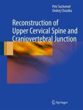 book Reconstruction of Upper Cervical Spine and Craniovertebral Junction