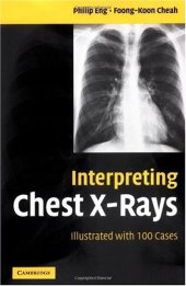 book Interpreting Chest X-Rays: Illustrated with 100 Cases