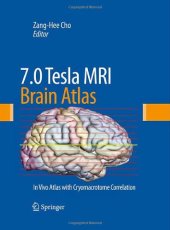 book 7.0 Tesla MRI Brain Atlas: In Vivo Atlas with Cryomacrotome Correlation