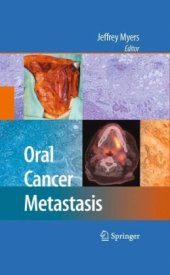 book Oral Cancer Metastasis