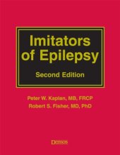 book Imitators of Epilepsy, Second Edition