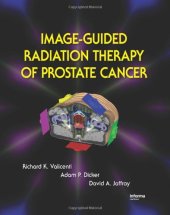 book Image-Guided Radiation Therapy of Prostate Cancer