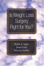 book Is Weight Loss Surgery Right for You? (Treatments That Work)