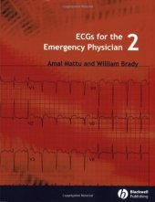 book ECGs for the Emergency Physician 2