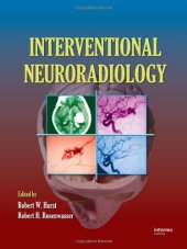 book Interventional Neuroradiology