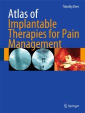 book Atlas of Implantable Therapies for Pain Management
