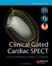 book Clinical Gated Cardiac SPECT