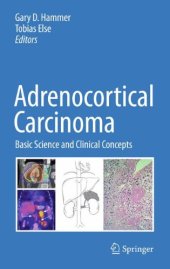 book Adrenocortical Carcinoma: Basic Science and Clinical Concepts