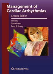 book Management of Cardiac Arrhythmias