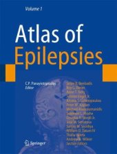 book Atlas of Epilepsies