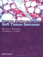 book Diagnosis and Management: Soft Tissue Sarcoma