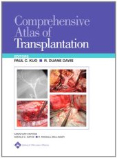 book Comprehensive Atlas of Transplantation