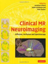 book Clinical MR Neuroimaging: Diffusion, Perfusion and Spectroscopy