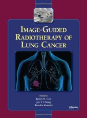 book Image-Guided Radiotherapy of Lung Cancer