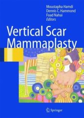 book Vertical Scar Mammaplasty