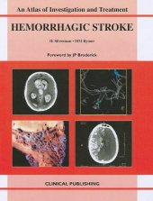 book Hemorrhagic Stroke: An Atlas of Investigation and Treatment (Atlas of Assessment, Diagnosis and Management)