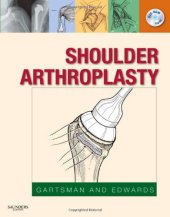 book Shoulder Arthroplasty