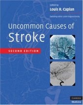 book Uncommon Causes of Stroke, 2nd edition