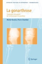 book La gonarthrose : Traitement chirurgical : de l'arthroscopie à la prothèse