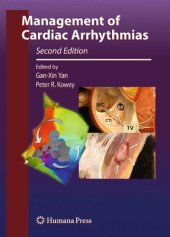 book Management of cardiac arrhythmias