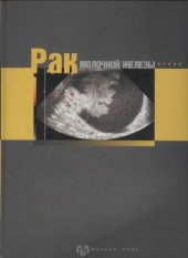 book Рак молочной железы. Атлас