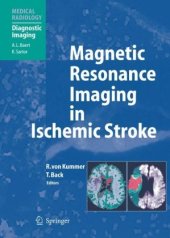 book Magnetic Resonance Imaging in Ischemic Stroke