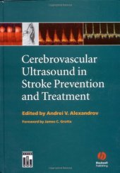 book Cerebrovascular Ultrasound in Stroke Prevention and Treatment