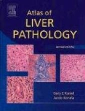 book Atlas of Liver Pathology, Second Edition (ATLAS OF SURGICAL PATHOLOGY)