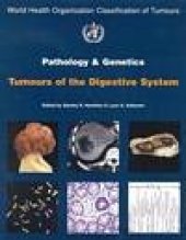 book Pathology and Genetics of Tumours of the Digestive System   (World Health Organization Classification of Tumours)