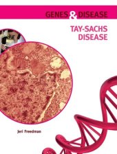 book Tay Sachs Disease (Genes and Disease)